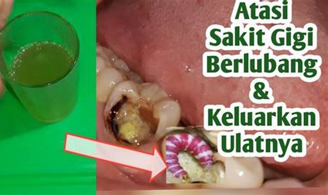 Cara Mengatasi Sakit Gigi Cara Mengatasi Sakit Gigi
